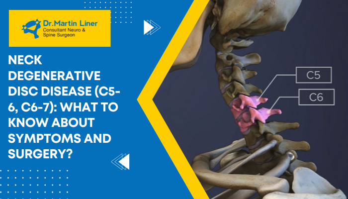 neck degenerative disc disease